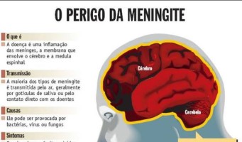 Secretaria de Saúde de Cachoeirinha confirma dois casos de meningite