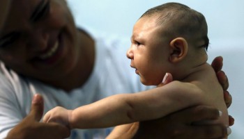Campanha arrecada doações para bebês com microcefalia em Caruaru