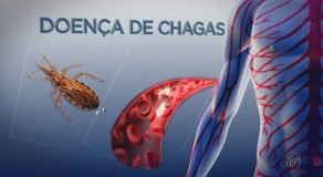 Sobe para 27 o saldo de pacientes que estão recebendo tratamento para doença de Chagas, em PE 